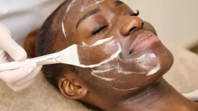 peeling-cosmetique-totale